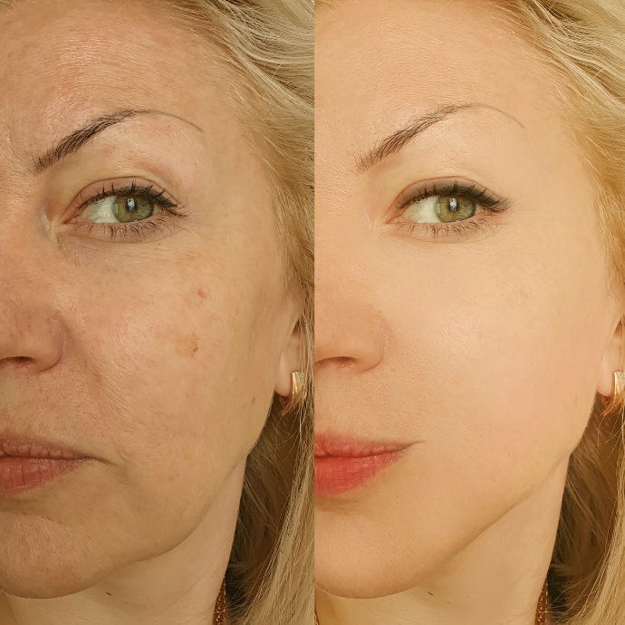 cosmética natural